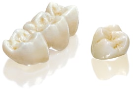 dental crowns Temecula
