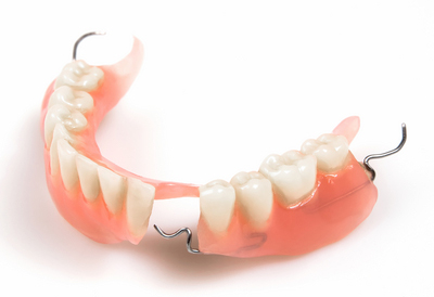 How Long Do Dentures Last? Signs It’s Time for a Replacement