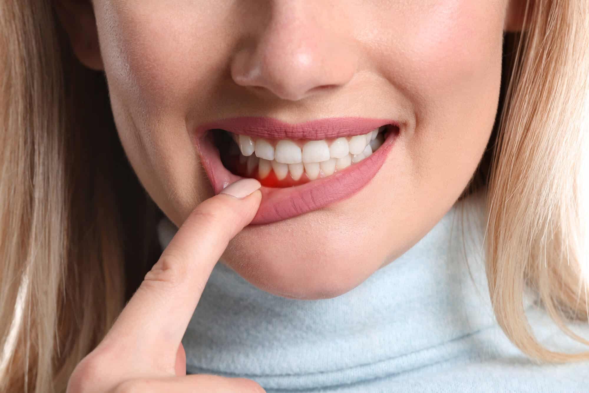 gum disease treatments